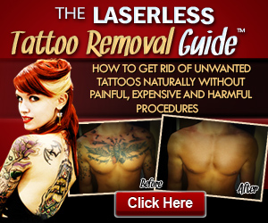 Revlite Laser Tatoo Removal PDF