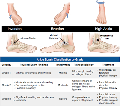 Angkle Sprain Classification by Grade