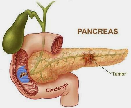 http://obattumorpankreas1.blogspot.com/
