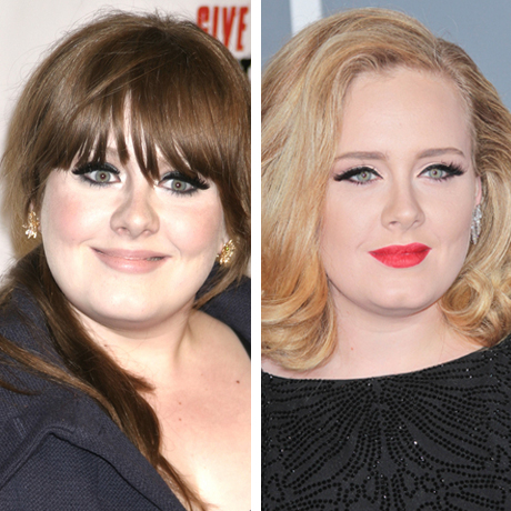 Chatter Busy: Adele Plastic Surgery