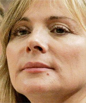 Kim Cattrall Fat Injections