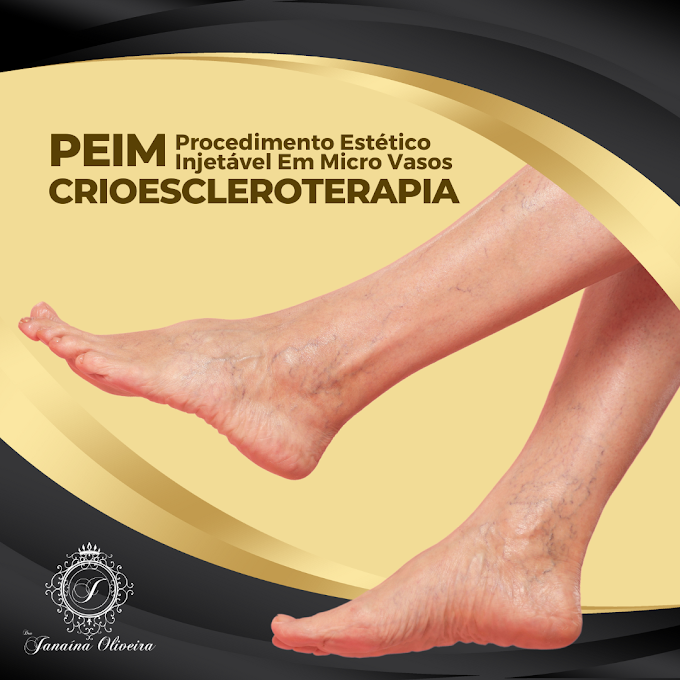 PEIM - Método CrioEscleroterapia