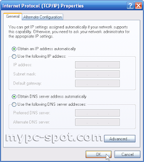 Set IP Address Dinamis