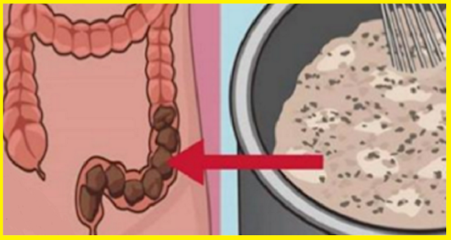وصفة رائعة لإزالة كامل البراز المتراكم في الجهاز الهضمي و تطهير القولون  معه والجسم كله بهذه الوصفة - سبحان الله 