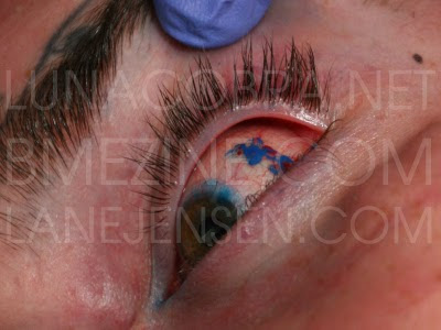 eye tattoo pictures, eye tattoos he eyeball tattooing procedures were done 