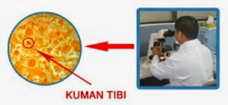 SHAKLEE MEMBANTU MERAWAT PESAKIT TIBI