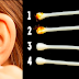 Your Earwax Can Indicate Your Health And Conditions: What Color Is Yours?