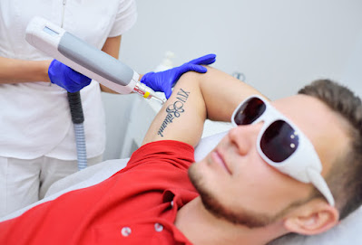 Tattoo removal methods