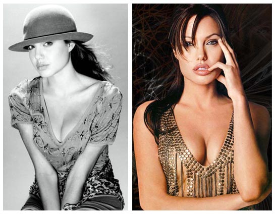 megan fox before after plastic surgery. megan fox plastic surgery