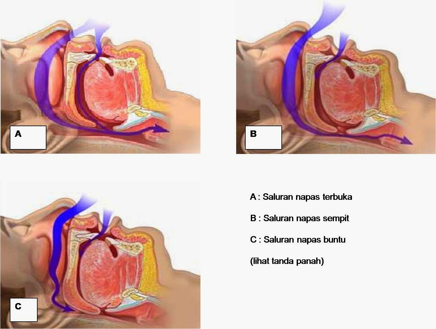 Fakta Menakutkan Dibalik Mendengkur