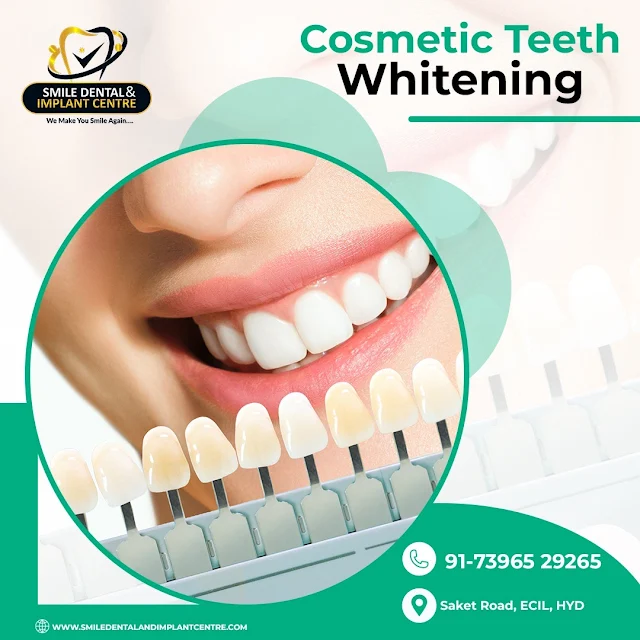 Teeth Whitening
