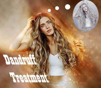 dandruff-ayurvedic-treatment