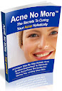 How To Remove Acne Natural Treatment Quickly 