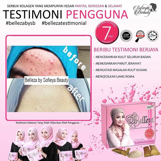 Belleza Advance Murah