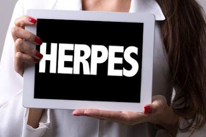 Fakta Seputar Penyakit Seksual Herpes Genital