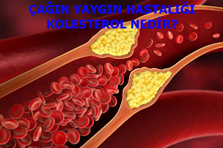 ÇAĞIN YAYGIN HASTALIĞI KOLESTEROL NEDİR?