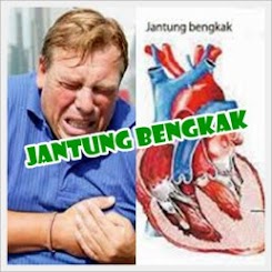 Solusi Obat jantung Bengkak Alami 