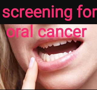 Screening for oral cancer