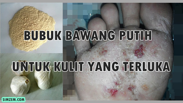 bawang putih untuk luka