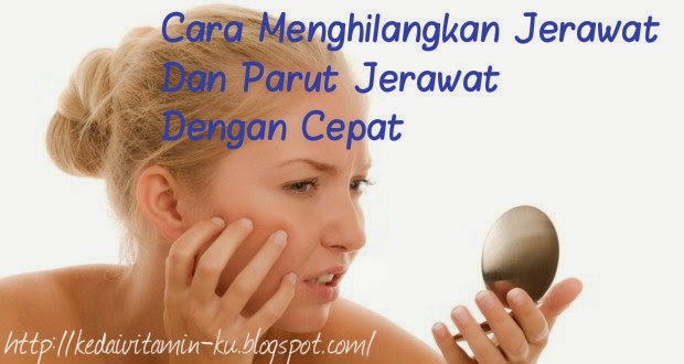 Cara Menghilangkan Jerawat Dan Parut Jerawat Dengan Cepat 