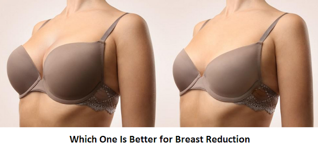 Which One Is Better for Breast Reduction?