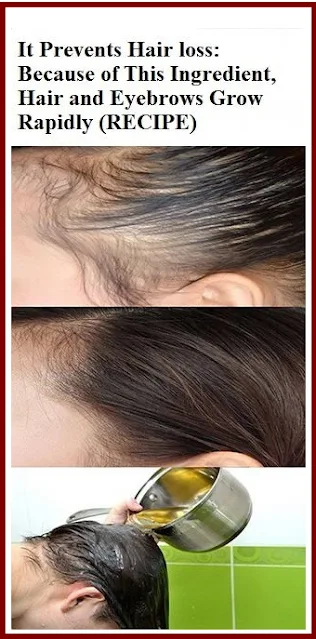 It Prevents Hair Loss: Because Of This Ingredient, Hair And Eyebrows Grow Rapidly! (Recipe)