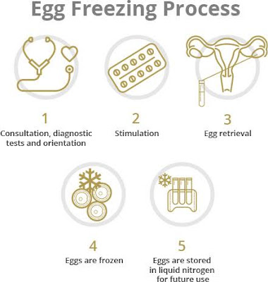 Egg Freezing or Oocyte Cryopreservation