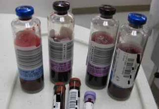 kan kültürü şişelere alınması