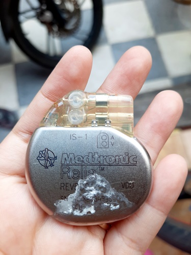 pacemaker, medtronic, pengalaman ganti pacemaker, harga pasang pacemaker