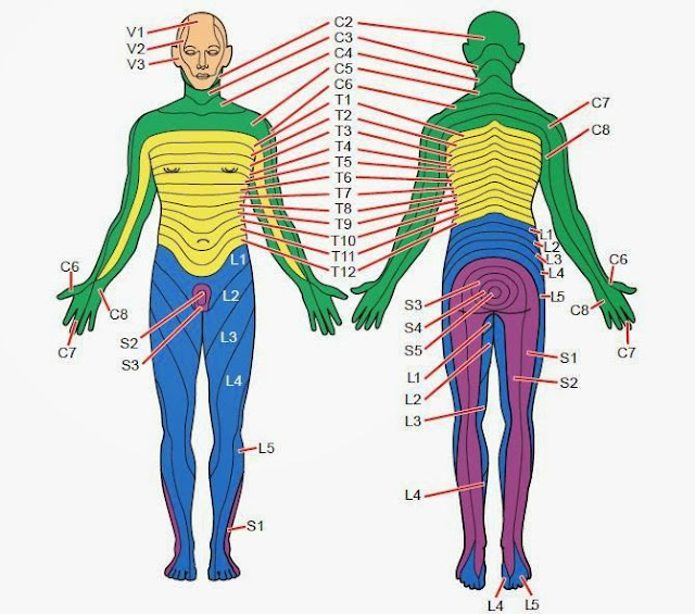 pakshaghat-paralysis-disease-ayurveda