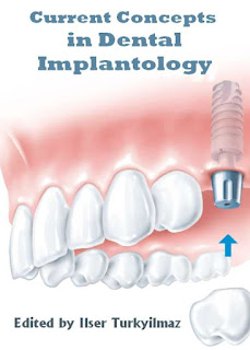 Current Concepts in Dental Implantology by Ilser Turkyilmaz PDF