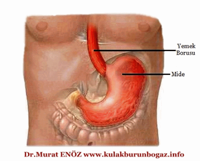 Gastroesophageal Reflux Disease (GERD)
