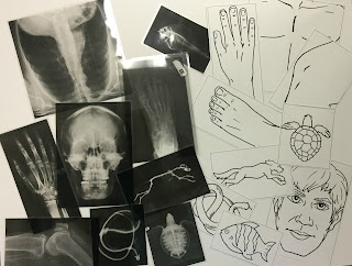 light-table-x-rays