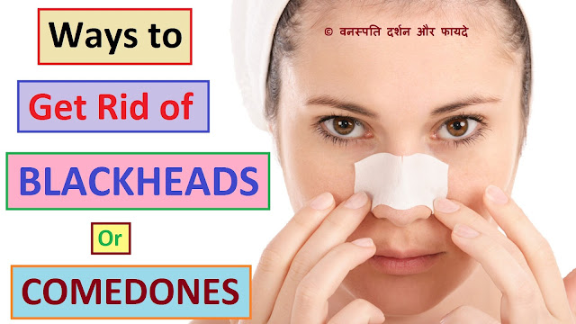 Ways to Get Rid of Blackheads or Comedones