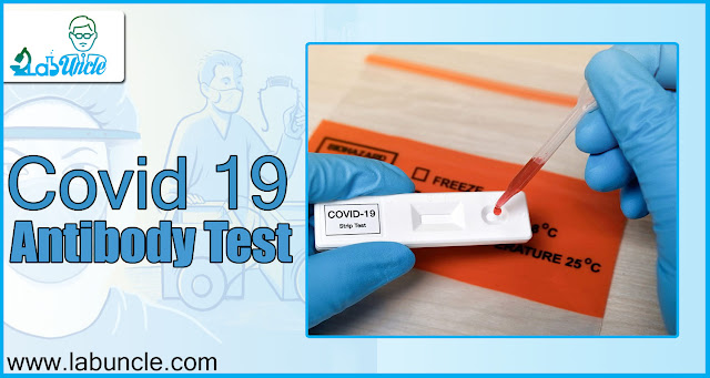 Covid 19 Antibody Test