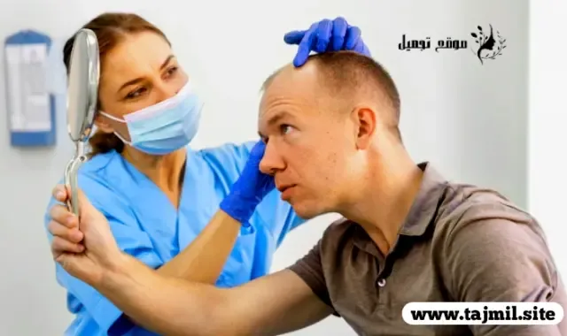 أسعار عمليات زراعة الشعر في تركيا - إسطنبول: تكاليف وتفاصيل العلاج