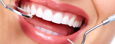 Cạo vôi răng có an toàn không?