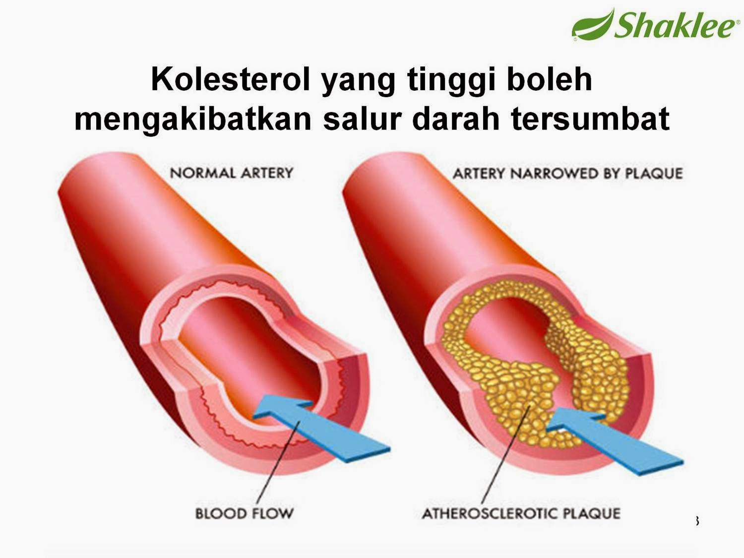 Badan Sihat Hati Ceria: PHYTOCOL-ST-SHAKLEE MEMBANTU 