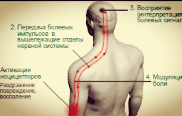 Понимание симптомов невропатии