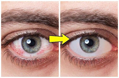 Utiliser de la myrtille pour rendre le blanc des yeux plus blanc et brillant
