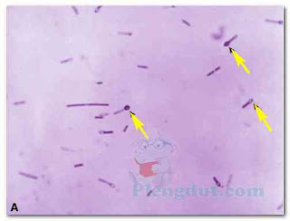 Terminal and subterminal spores. A. Gramstained Clostridium tetani bacteria, revealing terminal spores (arrows). C. tetani causes the disease known as tetanus. (Courtesy of Dr. Holdeman and the CDC.)