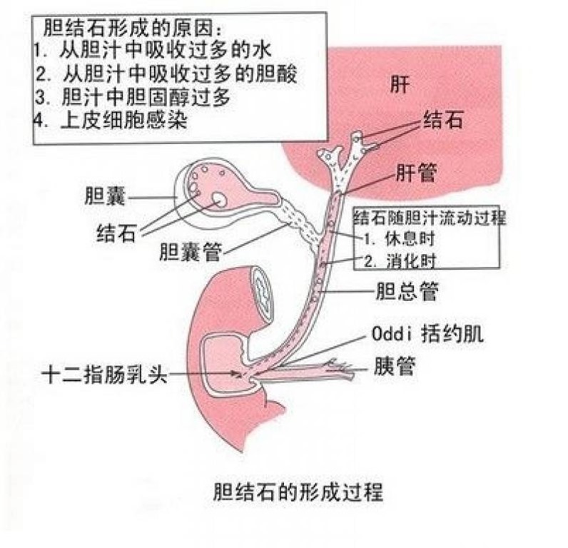 clip_image004