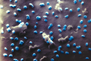 coronavirus a microscopio