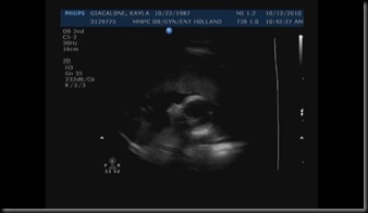 Image2