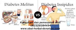 obat diabetes militus,obat herbal diabetes,obat diabetes herbal,cara mengobati diabetes secara herbal,pengobatan diabetes secara herbal,pengobatan diabetes tanpa resep dokter