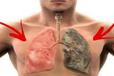 مشروبات لتنظيف الرئة: تعزيز صحة الجهاز التنفسي بطرق طبيعية