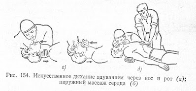 Искусственное дыхание вдуванием через нос и рот