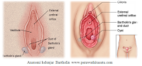 kista bartholini, askep kista bartholini, gambaran kista bartholini