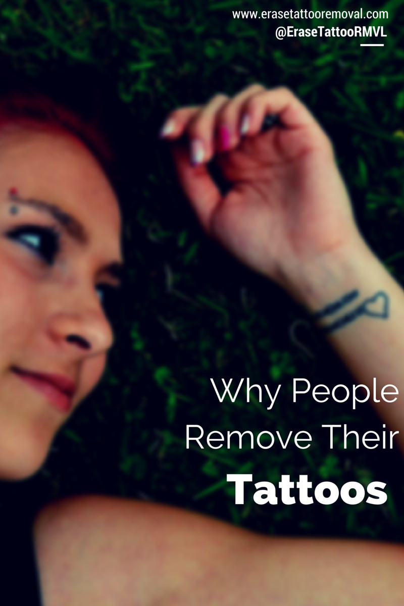  Why Remove A Tattoo