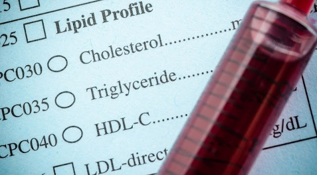 What are Cholesterol Numbers and How to Understand Them?